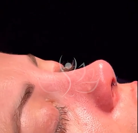 Video thumb