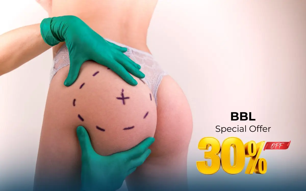 Special offer: BBL — 30% off