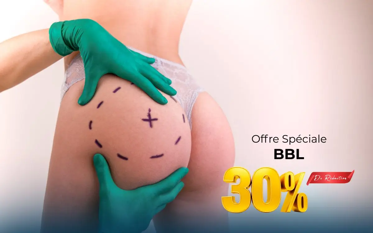 Offre spéciale : BBL — 30 % de remise