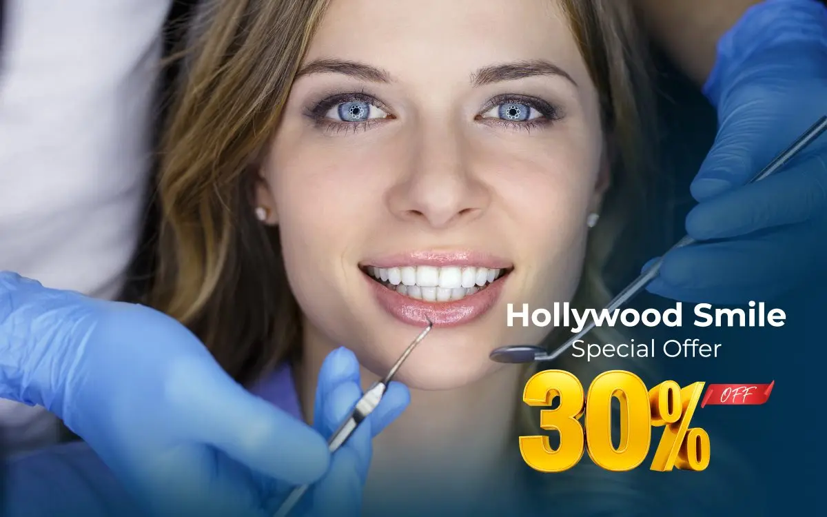 Special offer: Hollywood Smile — 30% off