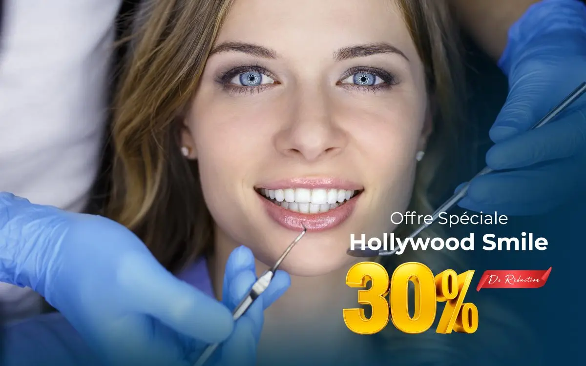 Offre spéciale : Hollywood Smile — 30 % de remise