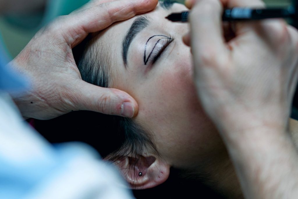 Facelift Recovery: What to Expect
