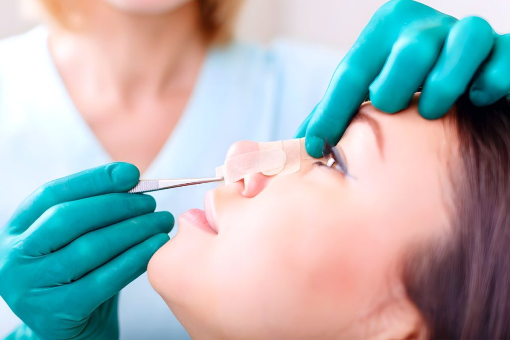 Primary vs Revision Rhinoplasty