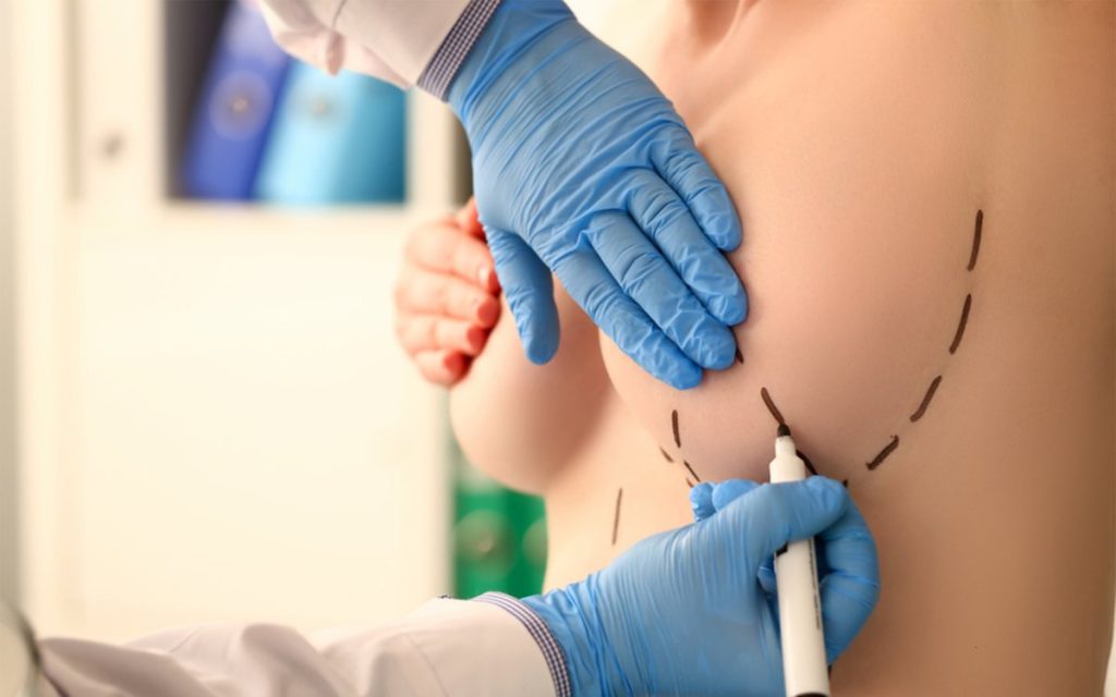Medical examination before body contouring