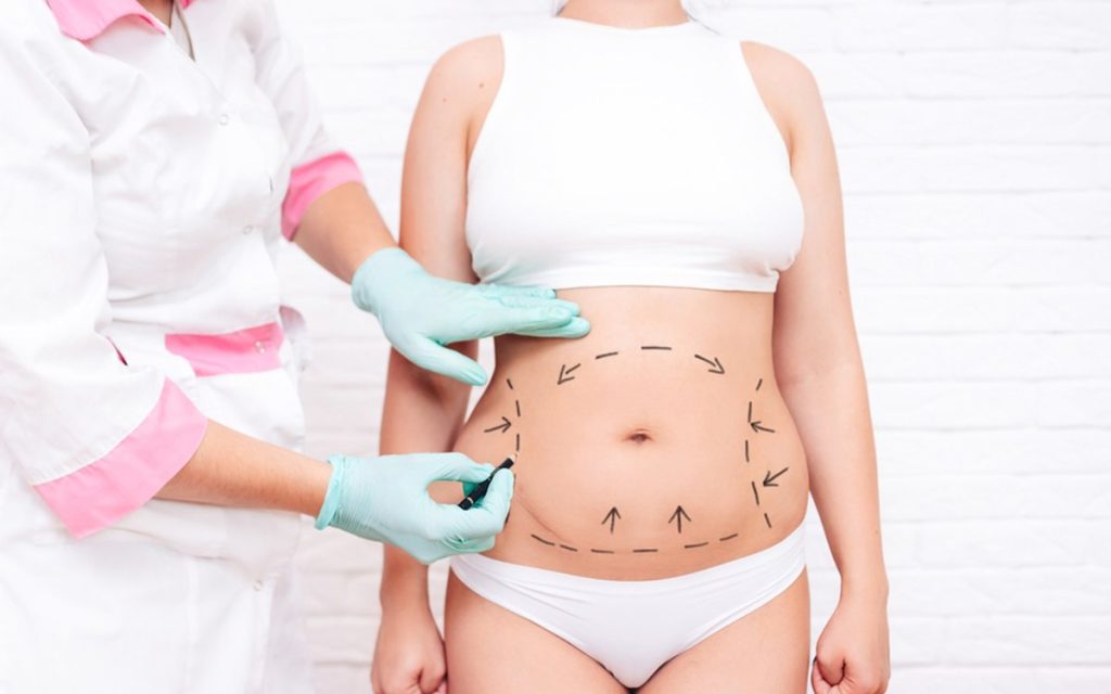 Medical assessment before body contouring — Jelan Clinic Istanbul