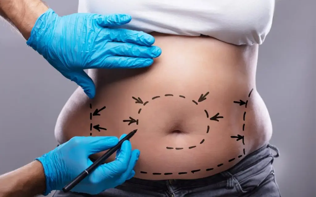 BBL and body contouring — Jelan Clinic, Istanbul