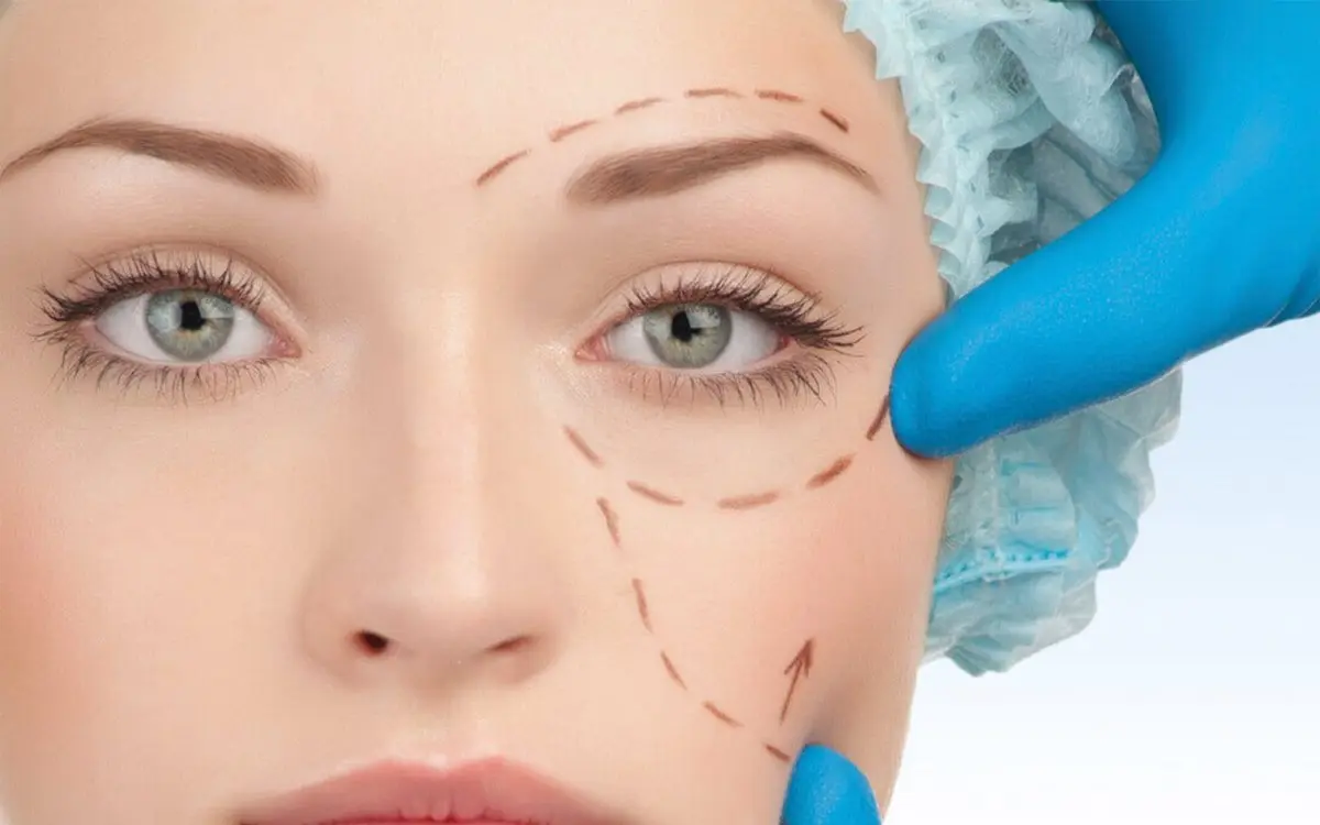 Facial surgery marking