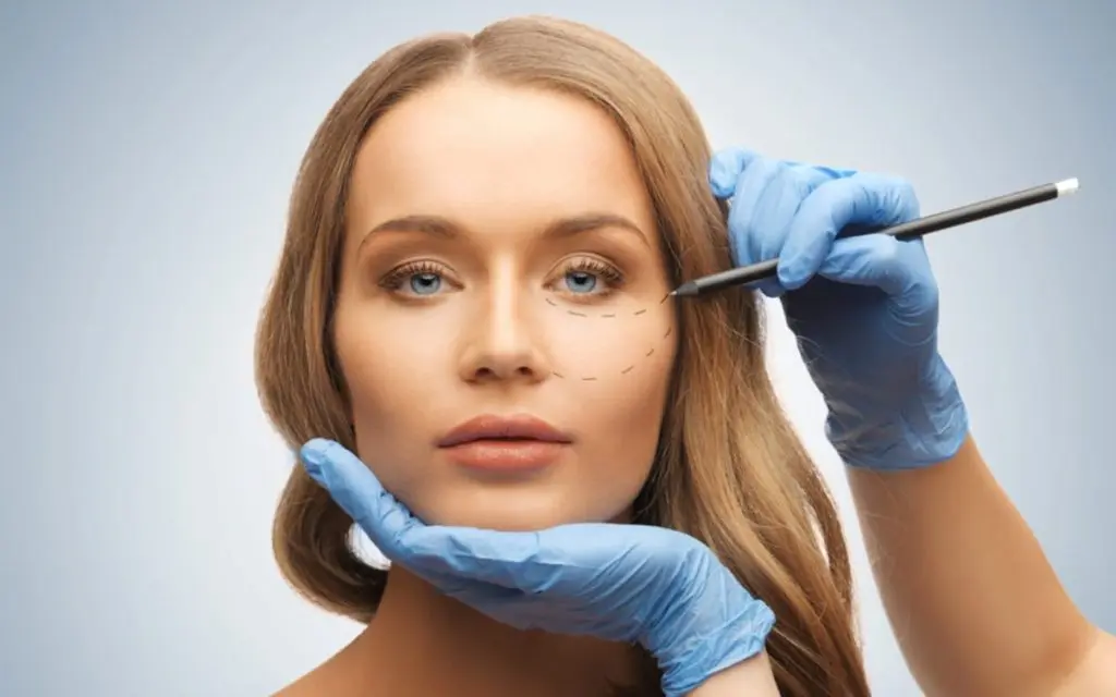 Rhinoplasty