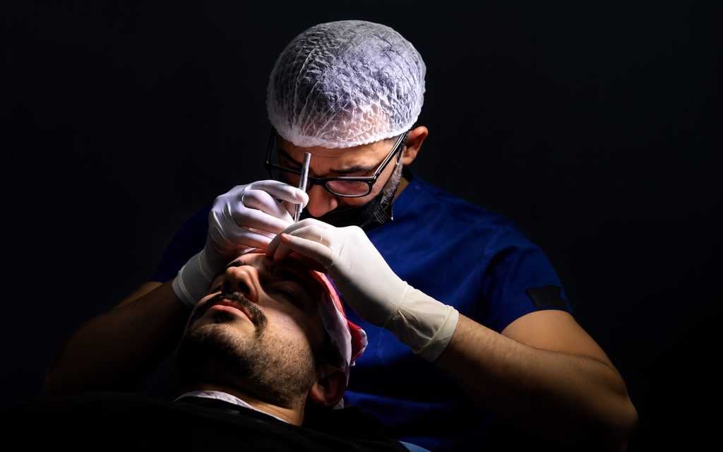 Questions to Ask Before Rhinoplasty